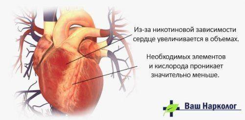 Сердце курильщика