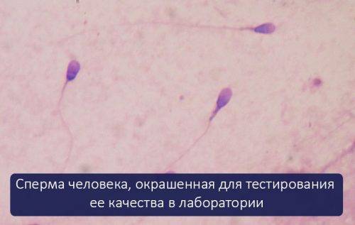 Сперматозоиды под микроскопом