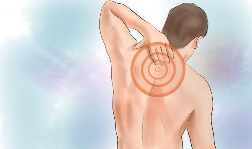 Болит спина между лопатками — почему, причины и лечение. почему болит между лопатками на спине?