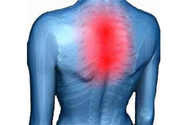 Боль между лопатками - причины, лечение, профилактика