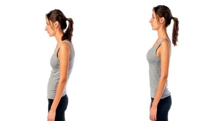 Как выпрямить осанку в домашних условиях: лучшие упражнения и рекомендации