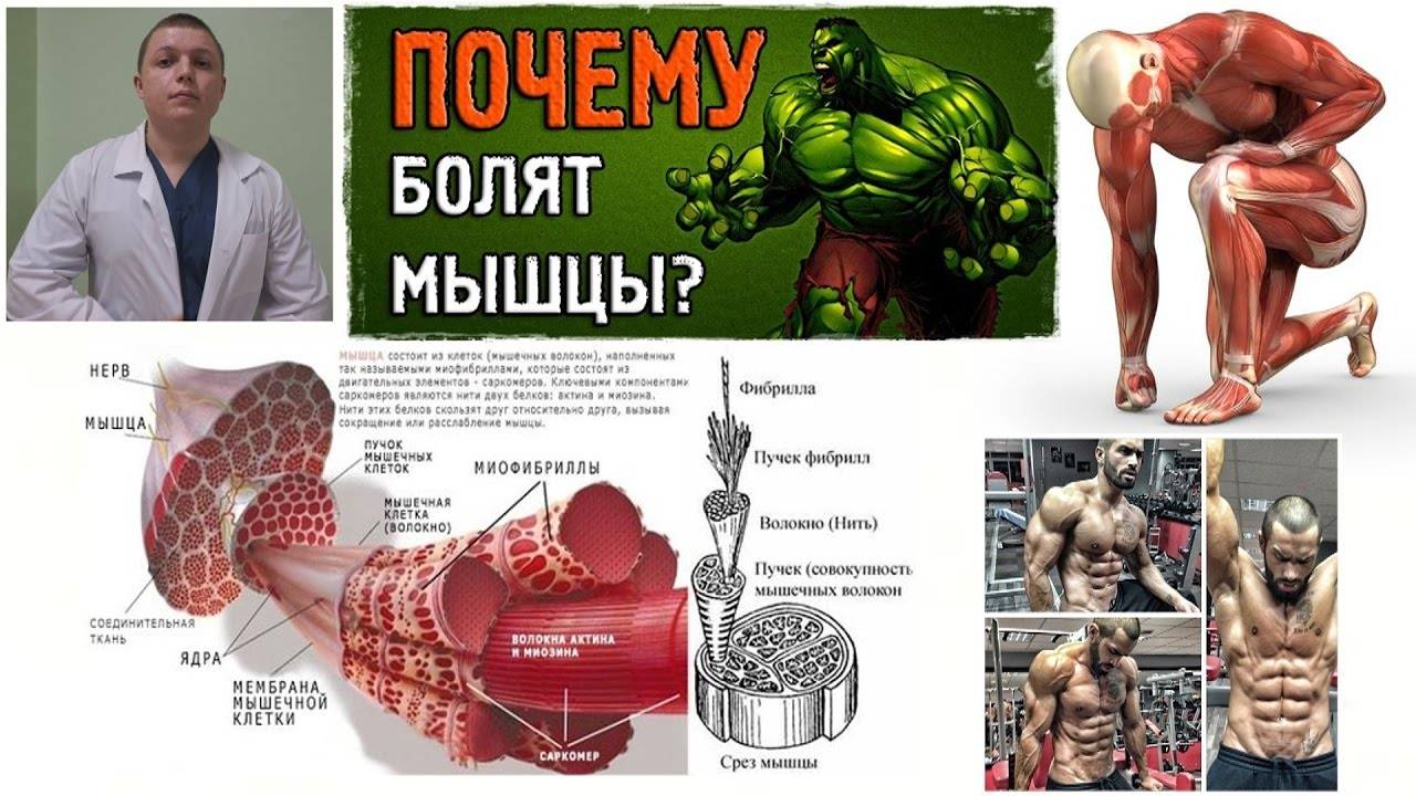 Почему болят мышцы после тренировки и что делать, можно ли тренироваться