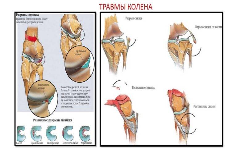 Народные методы лечения боли в коленных суставах: как не навредить себе