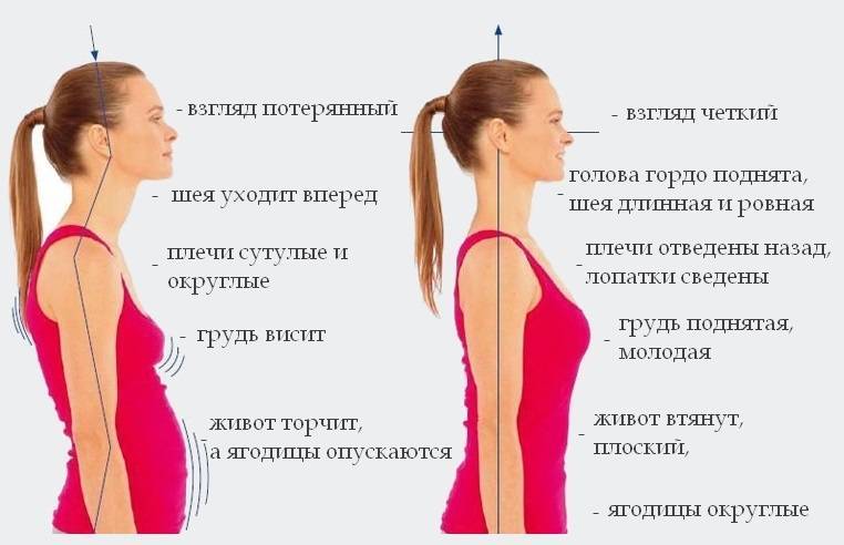 Как исправить сутулость — упражнения для осанки