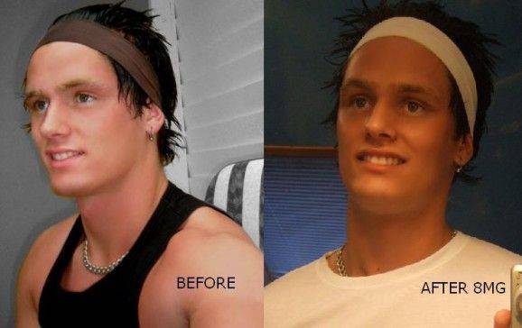 Меланотан для загара: свойства, инструкция по применению и виды препарата