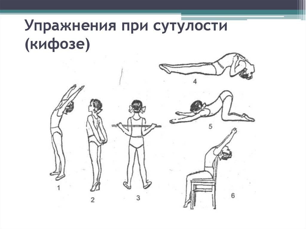 Эффективные упражнения против сутулости