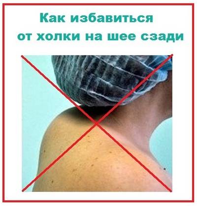 Как избавиться от холки на шее сзади у женщин в домашних условиях, массаж, упражнения