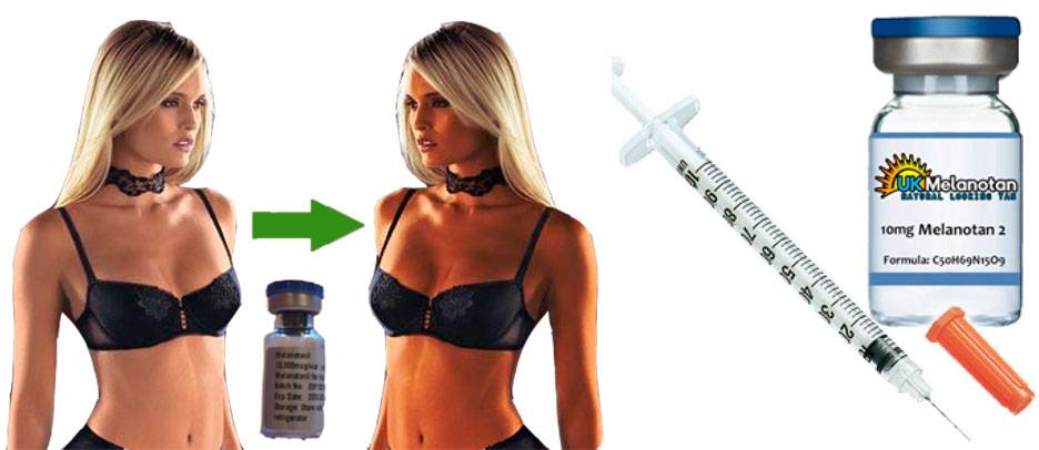 Как быстро загореть: личный опыт использования меланотан-2