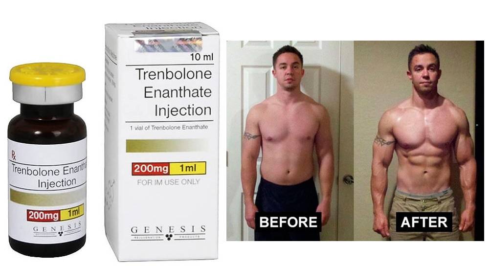 Курсы стероидов и гормон роста. Энантат 300 Соло. Энантат Тренболон станозолол. Винстрол Тренболон тестостерон. Тренболон+тестостерон энантат+туринабол.