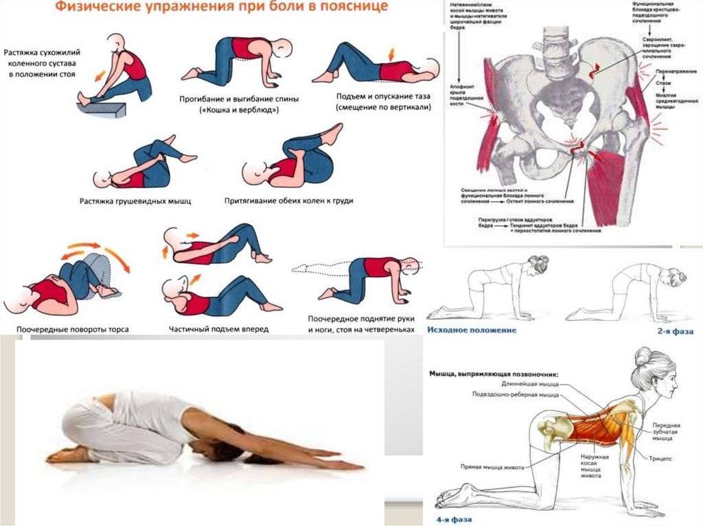 Упражнения при болях в спине и пояснице самые эффективные в картинках