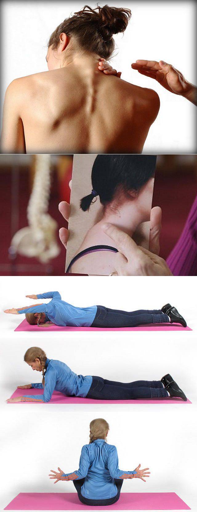 Вдовий горб. как быстро и эффективно избавиться в домашних условиях от горба на шее