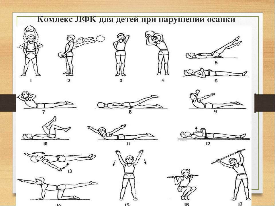 Комплекс упражнений при сколиозе презентация