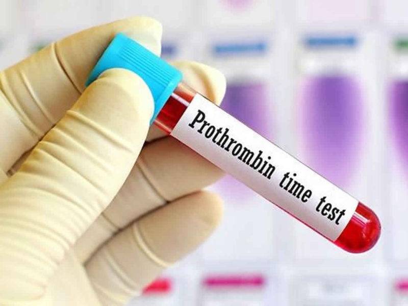 Повышенный и пониженный глобулин, связывающий половые гормоны