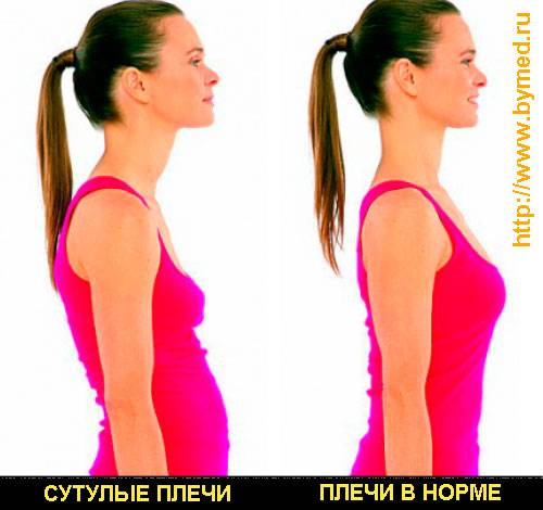 Как исправить осанку: простые упражнения и трюки - лайфхакер