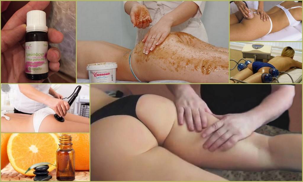 Как избавиться от целлюлита на ногах и попе в домашних условиях быстро