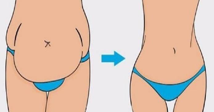 Как подтянуть кожу на животе после похудения и убрать дряблость в домашних условиях и салоне