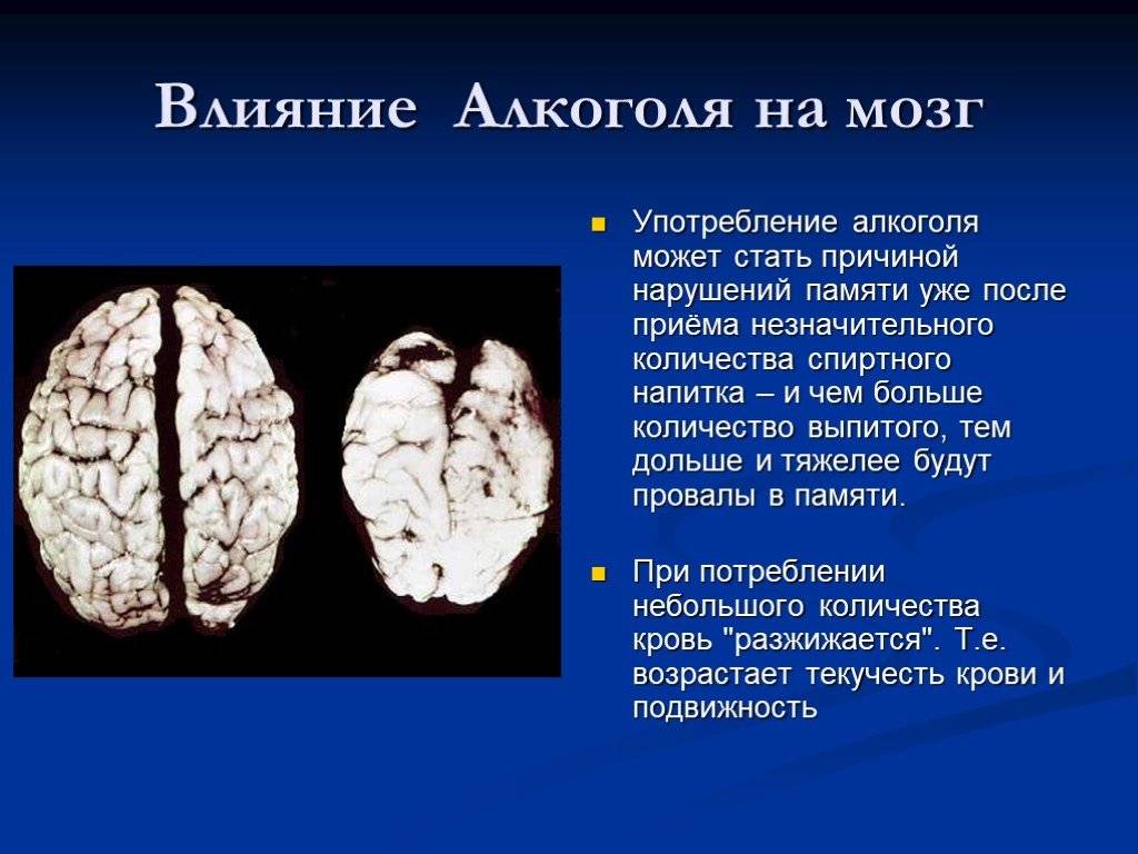 Что влияет на память. Воздействие алкоголя на головной мозг. Влияние алкоголя на мозг и нервную систему. Влияние спиртов на головной мозг.