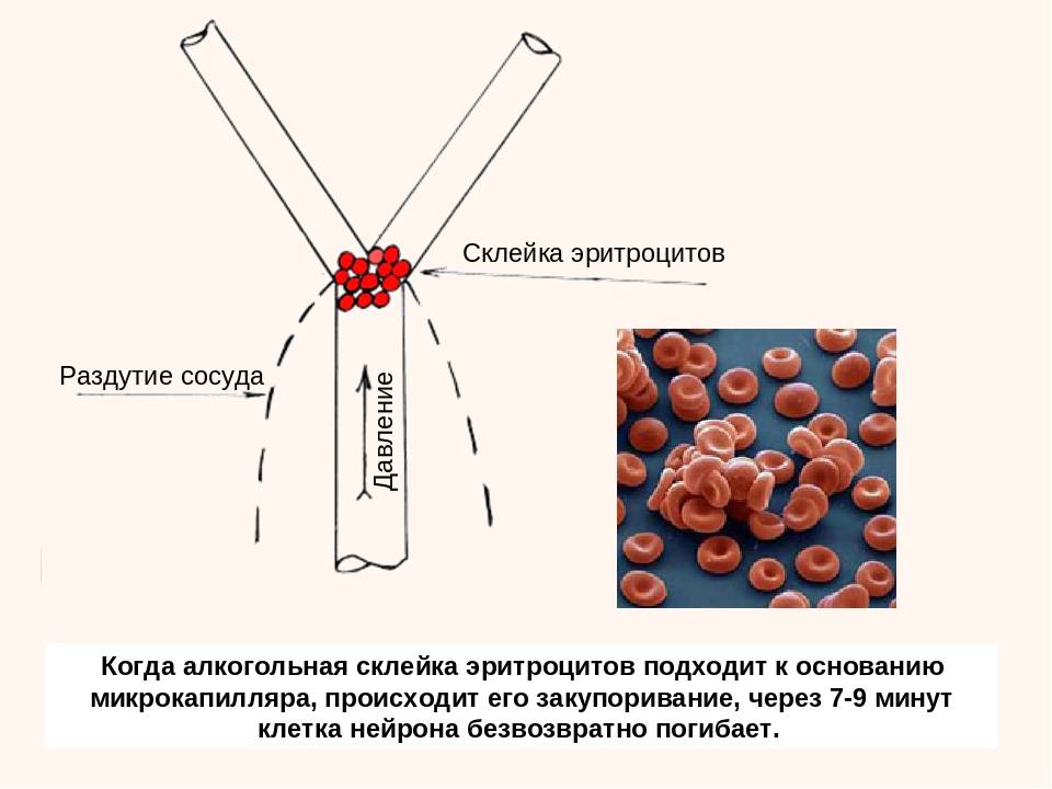 Как спиртное воздействует на кровеносные сосуды: очищение после запоя | medeponim.ru