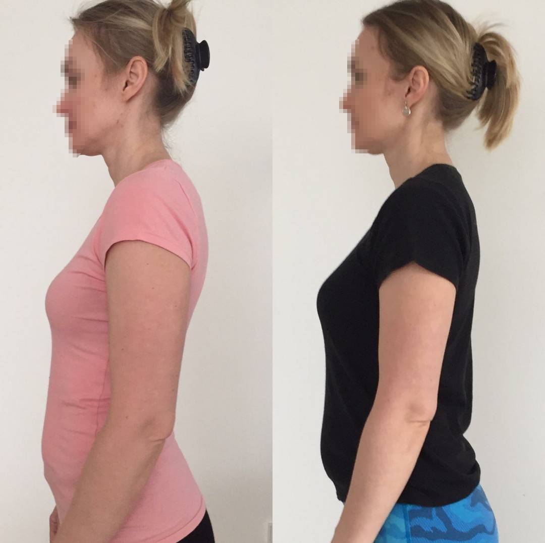 Как исправить осанку: простые упражнения и трюки - лайфхакер