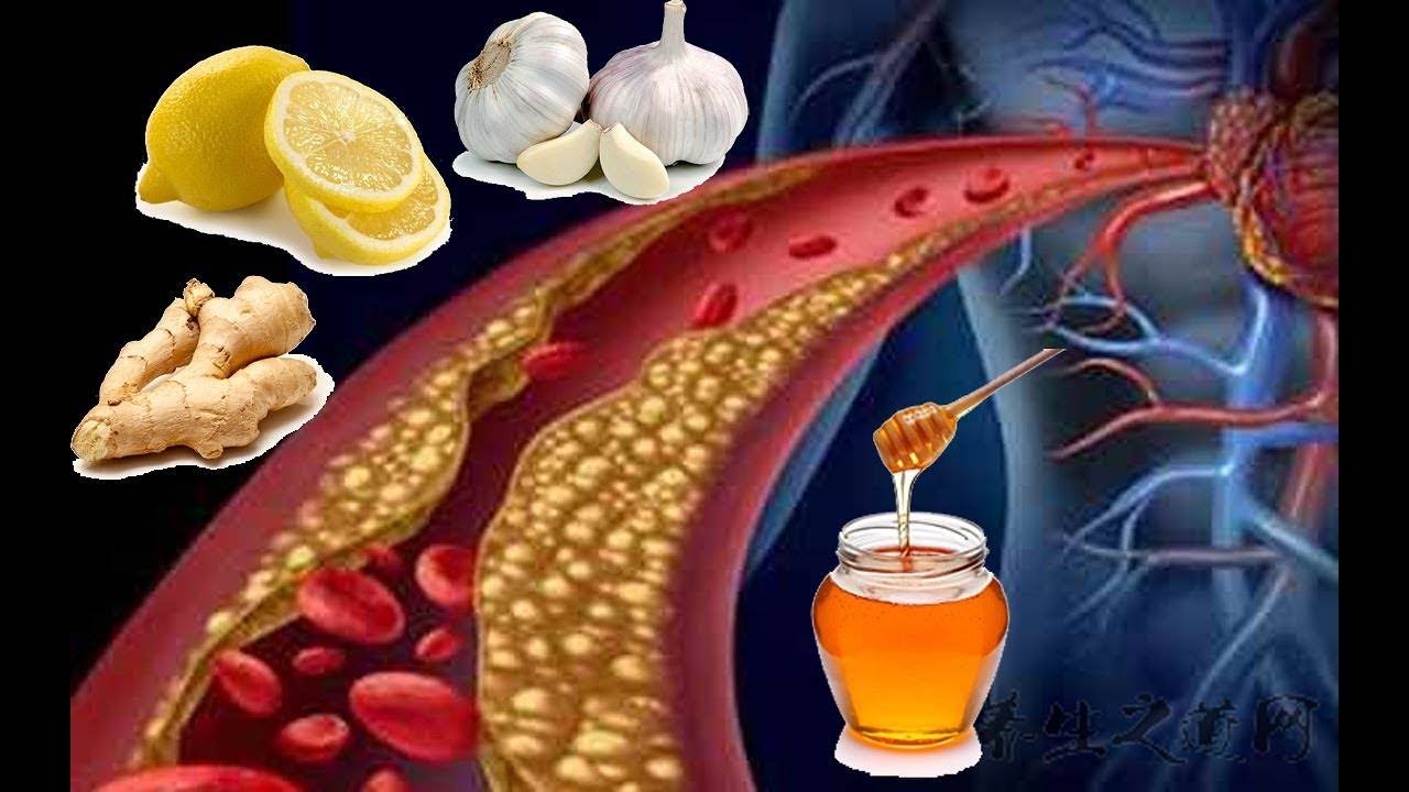 3 народных рецепта для очищения сосудов шелухой и соком лука