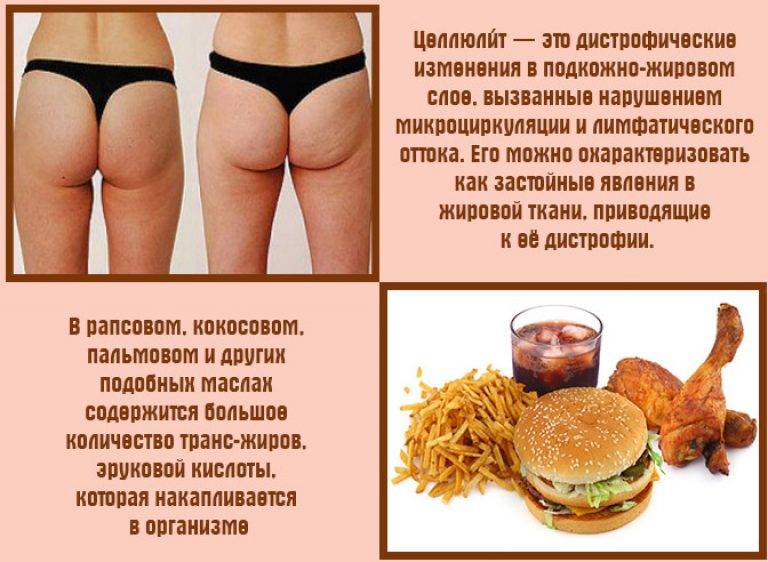 Как убрать целлюлит на попе и бедрах? рекомендации специалистов