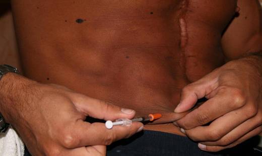 Меланотан 2