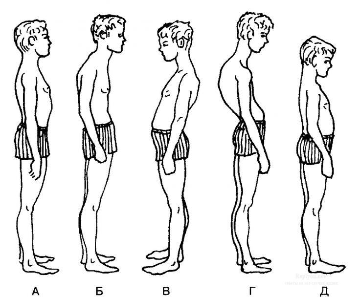 Избавляемся от сутулости – 5 эффективных упражнений