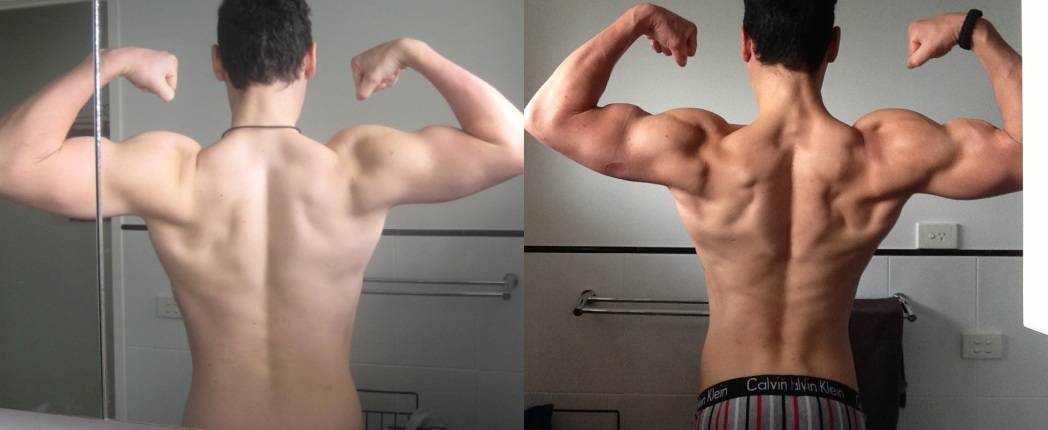 Меланотан 2 инструкция по применению противопоказания