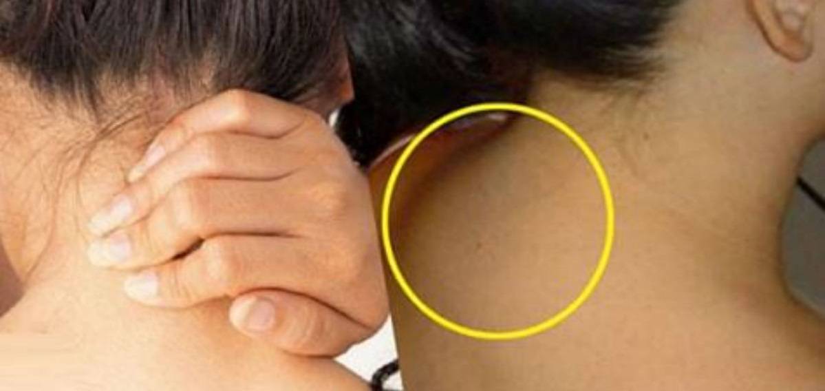 Как убрать холку на шее быстро и эффективно