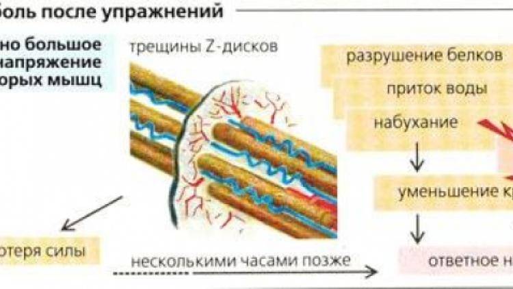 Боль в мышцах после тренировки. что делать, если болят мышцы?