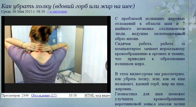 Как избавиться от холки на шее женщине и мужчине?