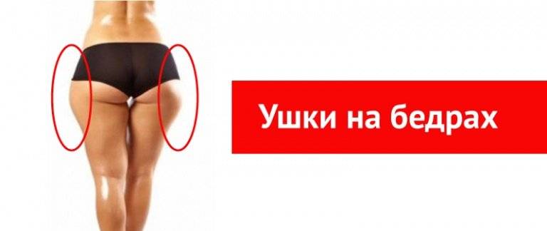 Убираем ушки на бедрах — стратегия избавления