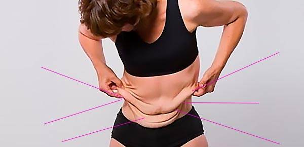 Как убрать обвисший живот: рабочие способы и средства. особенности избавления от фартука после кесарева и похудения