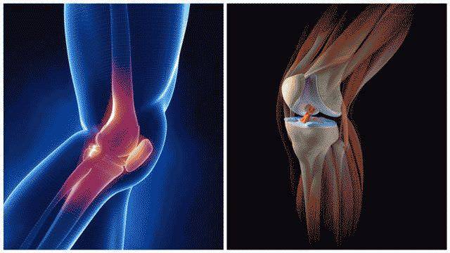 Болит колено при сгибании и разгибании: лечение, признаки