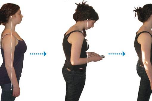 Исправление осанки раз и навсегда: разъясняем подробно