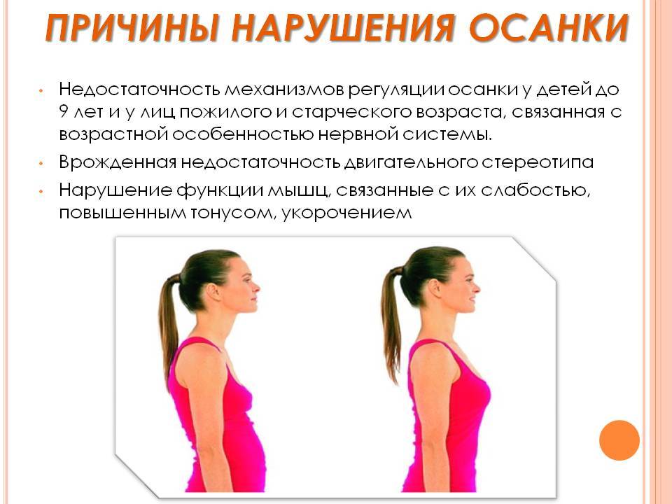 10 упражнений, которые за месяц исправят вашу осанку и избавят от боли в спине | в тренде