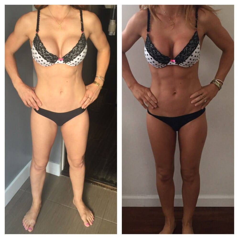 Меланотан: как принимать, дозировки, инструкция по разведению. меланотан для загара — есть побочный эффект меланотан 2 когда лучше принимать перед пляжем