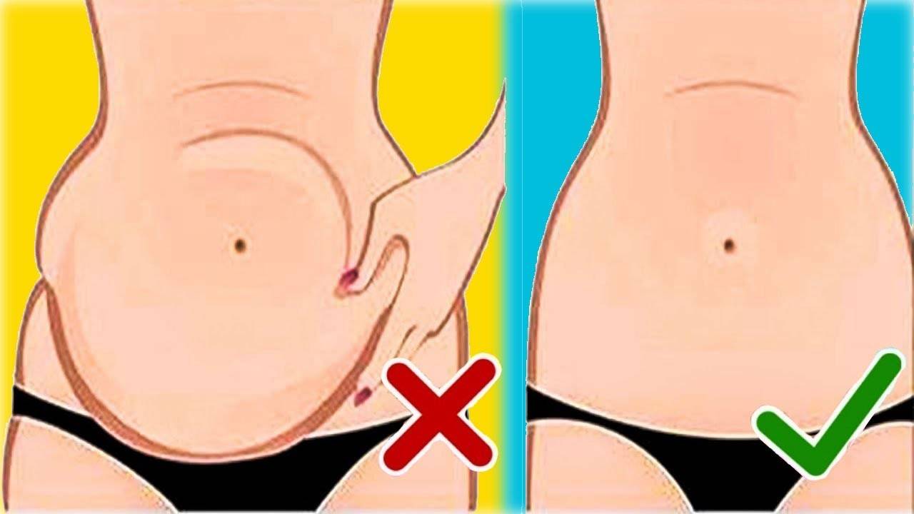 Причины обвисшего живота и как его убрать?