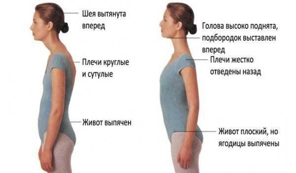 Как выровнять осанку: плечи, в домашних условиях, упражнения и за неделю