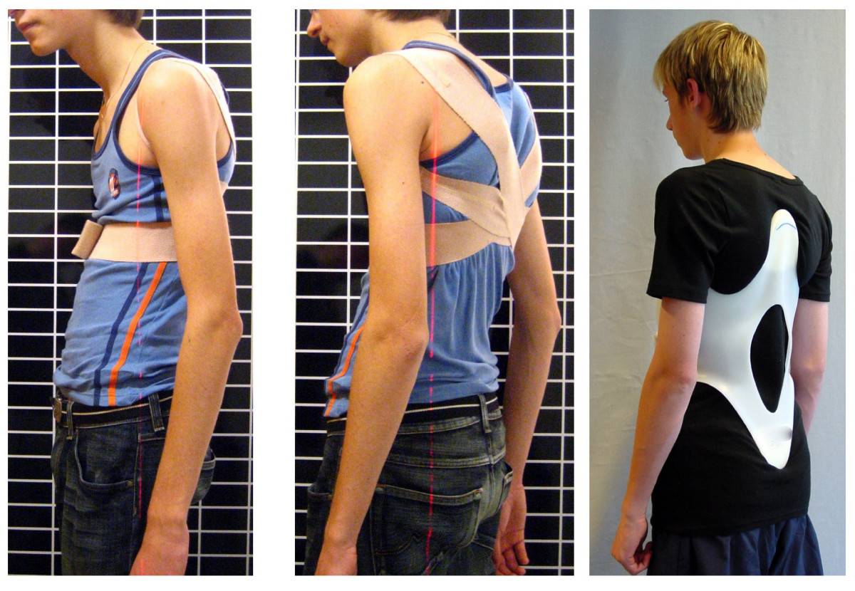 Как выровнять осанку в домашних условиях