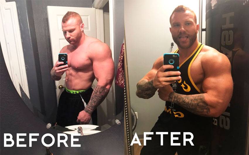 Препарат melanotan-2 имеет побочные эффекты