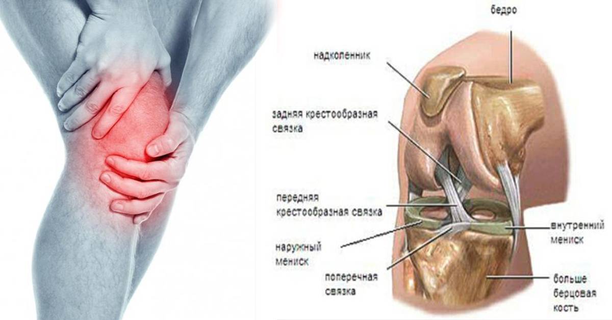 Боль в колене сбоку с внешней стороны: основные причины, лечение, сопутствующие симптомы
