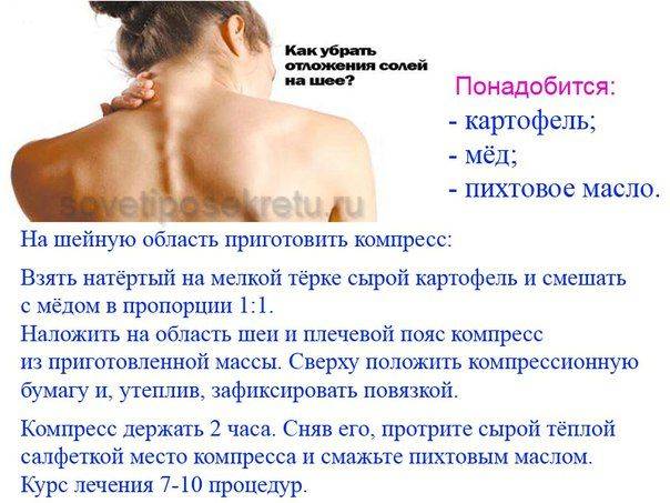 Как убрать холку на шее в домашних условиях упражнения