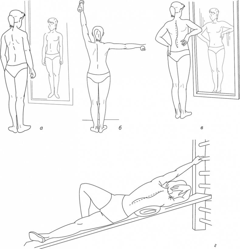 Упражнения и гимнастика при сколиозе в домашних условиях