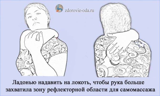 Болит холка на шее что делать