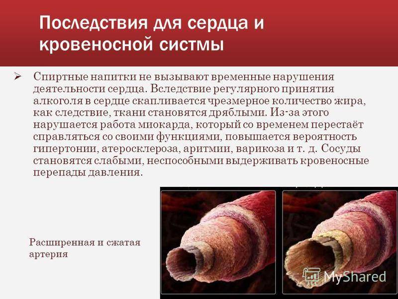 Как действует на сосуды. Влияние алкоголя на кровеносную систему человека. Влияние алкоголя на кровеносную систему кратко. Воздействие алкоголя на кровеносные сосуды. Влияние спирта на кровеносную систему.